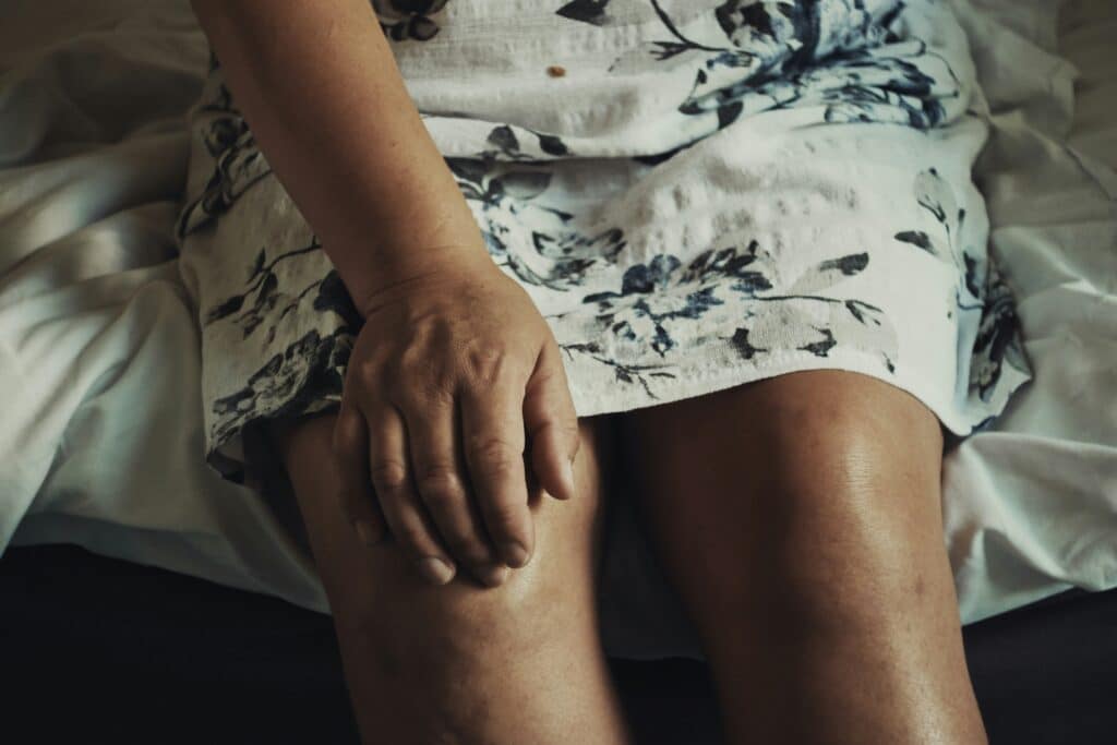 Woman with leg pain